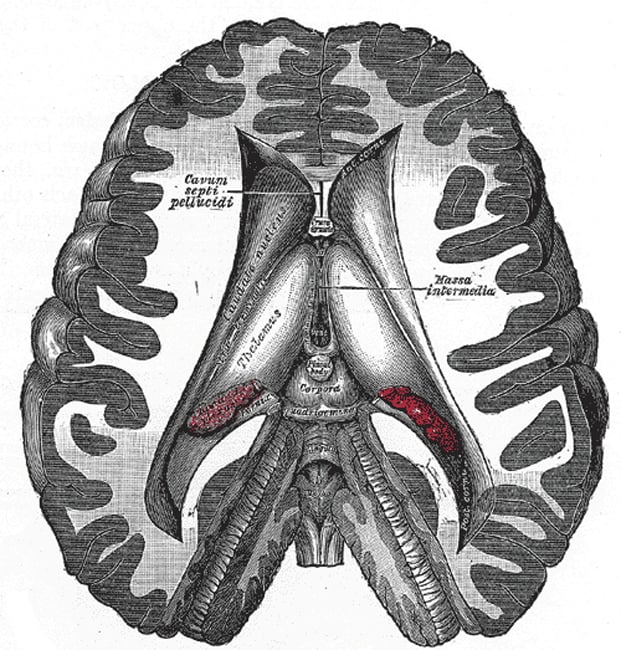 Dissection showing the ventricles of the brain – note the central position of the pineal gland (pineal body), here colored in grey.