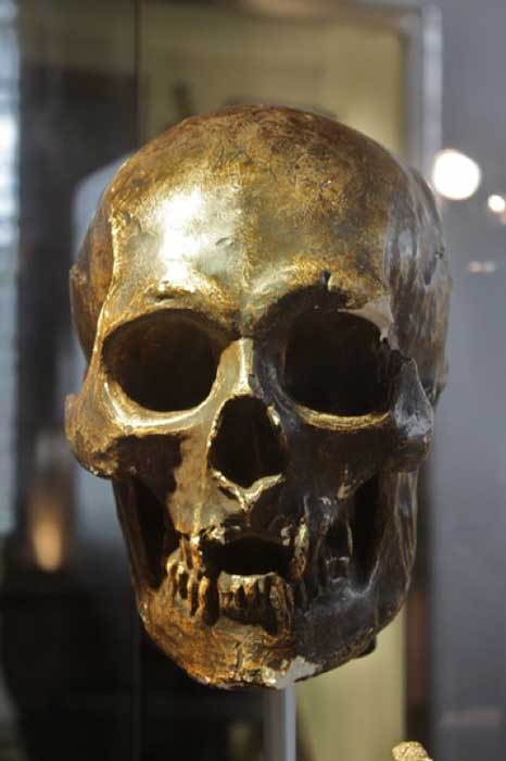 Plaster cast of skull of Robert the Bruce. Hunterian Museum and Art Gallery, Glasgow, Scotland. (Public License)
