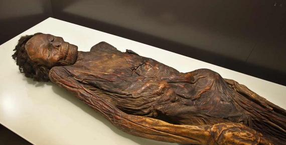 The Guanche mummy from Barranco de Herques belonged to an adult male aged around 35-40 years old. 